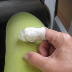 Mitt stackars finger