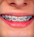 69x75_children_and_orthodontics_ref_guide