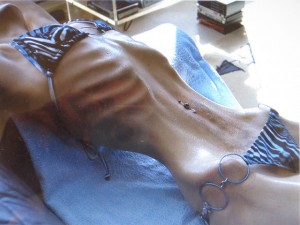 Anorexia
