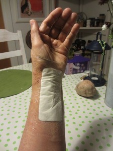 Min arm - hemma 11 nov 13
