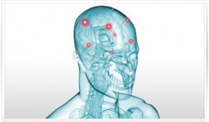 image-om-alzheimer-1