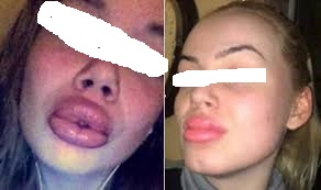 Duckfaces 6